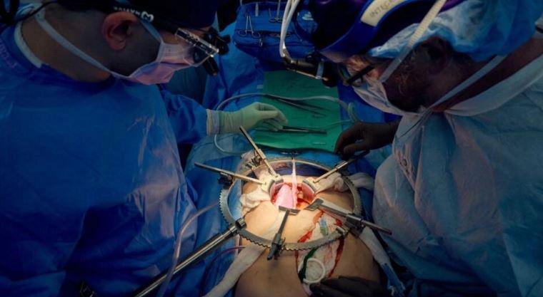 Un mois après, un rein de porc greffé sur un humain continue de fonctionner Un mois après, un rein de porc greffé sur un humain continue de fonctionner