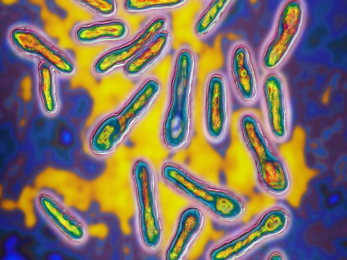 Cas de botulisme à Bordeaux : quelle est cette maladie rare et comment l’éviter ? Cas de botulisme à Bordeaux : quelle est cette maladie rare et comment l’éviter ?