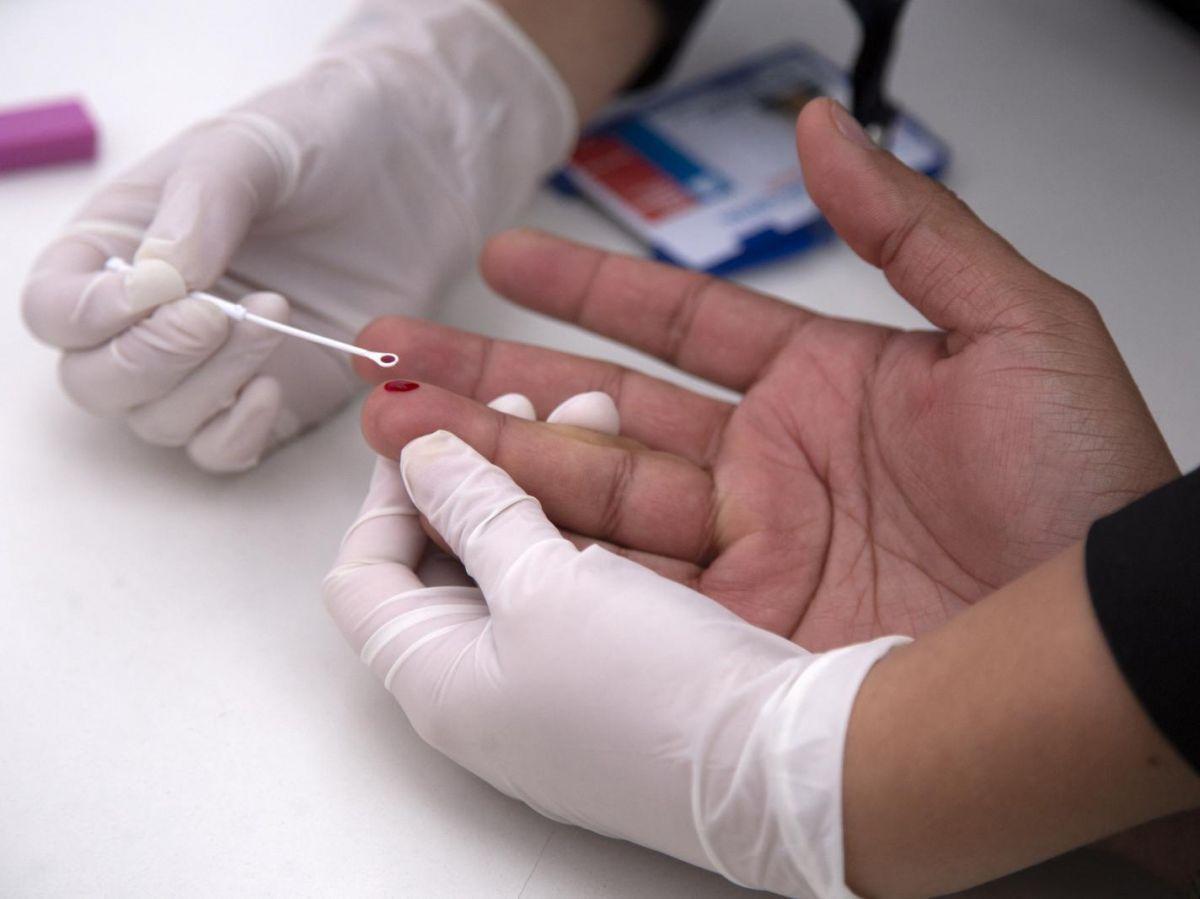 Sida : les cellules dormantes du VIH libèrent toujours de l’ARN, même sous thérapie Sida : les cellules dormantes du VIH libèrent toujours de l’ARN, même sous thérapie