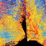 Poumons: BPCO, L’épidémie Silencieuse Poumons: BPCO, L’épidémie Silencieuse