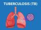 Communities Urged to Dispel TB Myths to Improve Treatment Communities Urged to Dispel TB Myths to Improve Treatment