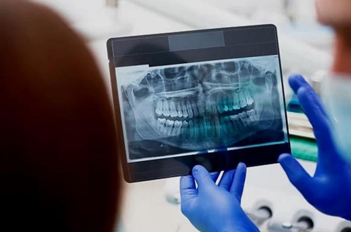 Des chercheurs japonais mettent au point le premier médicament permettant une nouvelle poussée des dents Des chercheurs japonais mettent au point le premier médicament permettant une nouvelle poussée des dents