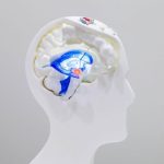 Lumière sur la maladie de Parkinson : un dispositif implanté dans la tête du patient ! Lumière sur la maladie de Parkinson : un dispositif implanté dans la tête du patient !