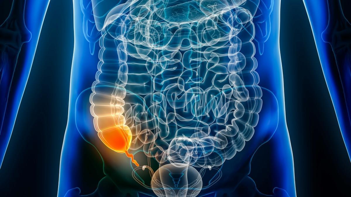L’Appendice, Vraiment Inutile? L’Appendice, Vraiment Inutile?