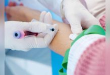 Maladie D’Alzheimer: un Test Sanguin Facilite le Diagnostic Maladie D’Alzheimer: un Test Sanguin Facilite le Diagnostic