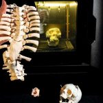 HôPital: L’Impression 3D pour une Médecine de Précision HôPital: L’Impression 3D pour une Médecine de Précision