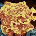 Le Cancer à L’épreuve des IA Génératives Le Cancer à L’épreuve des IA Génératives