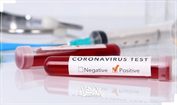 قرار بتوفير فحص PCR مجانا للطلاب المسافرين قرار بتوفير فحص PCR مجانا للطلاب المسافرين