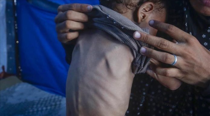 UN Report Warns of Deepening Hunger Crisis in 16 Hotspots UN Report Warns of Deepening Hunger Crisis in 16 Hotspots