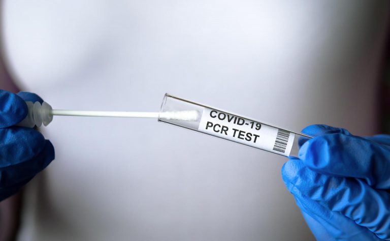 وزير الصحة يطالب المختبرات العمومية بإجراء اختبار PCR مجانا لمغاربة العالم
