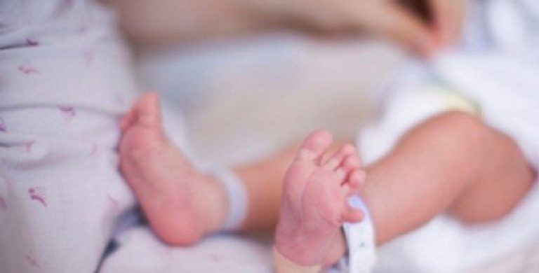 الرباط: الحالة الصحية للتوأم السيامي اللذين تم فصلهما قبل أيام جيدة