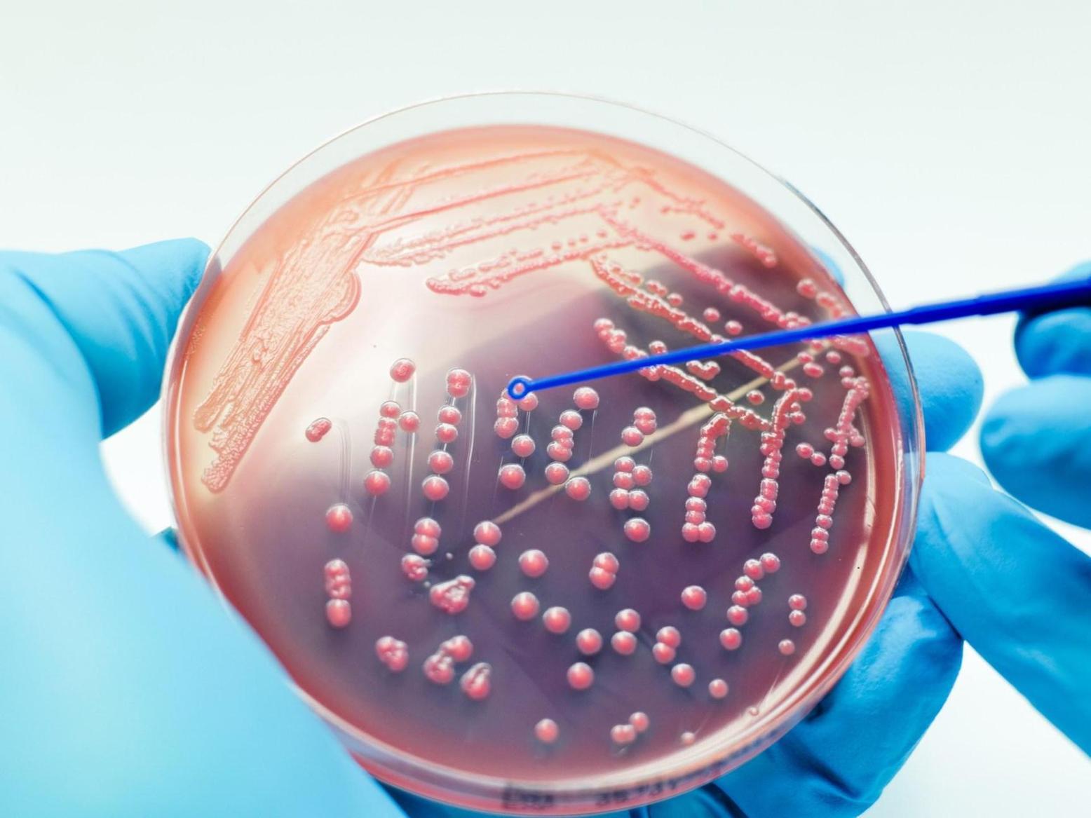 علماء روس يبتكرون مادة تصدر أشعة قاتلة للبكتيريا علماء روس يبتكرون مادة تصدر أشعة قاتلة للبكتيريا