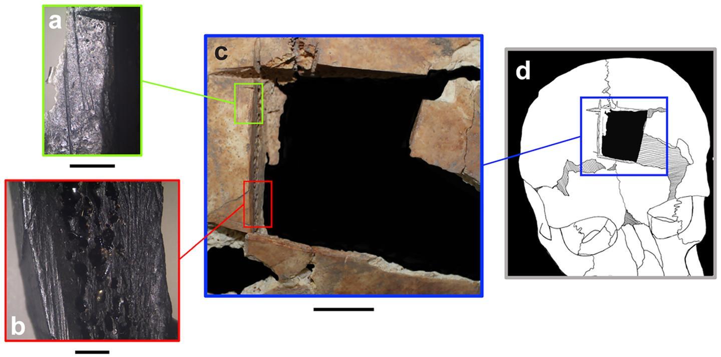 Archeologists Stunned After Discovering Possible Purpose of Square Hole in 3,500-Year-Old Skull Archeologists Stunned After Discovering Possible Purpose of Square Hole in 3,500-Year-Old Skull