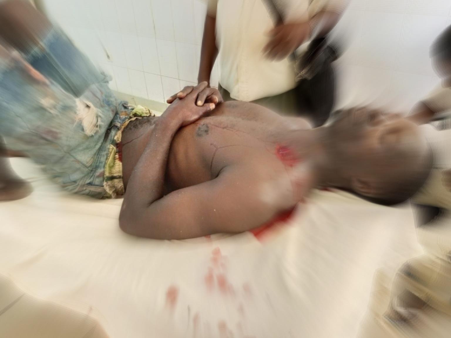 Dozens injured on the last day of campaigning in Nacala, Cuamba and Metangula – CIP Mozambique Elections Dozens injured on the last day of campaigning in Nacala, Cuamba and Metangula – CIP Mozambique Elections