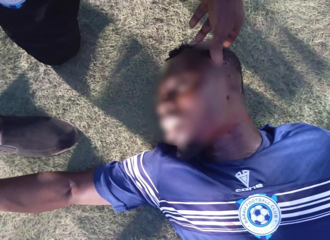 Barau FC Player Attacked in Katsina Draw Barau FC Player Attacked in Katsina Draw