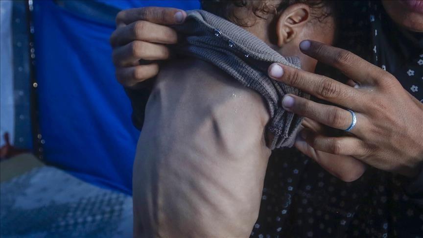 UN Report Warns of Deepening Hunger Crisis in 16 Hotspots UN Report Warns of Deepening Hunger Crisis in 16 Hotspots