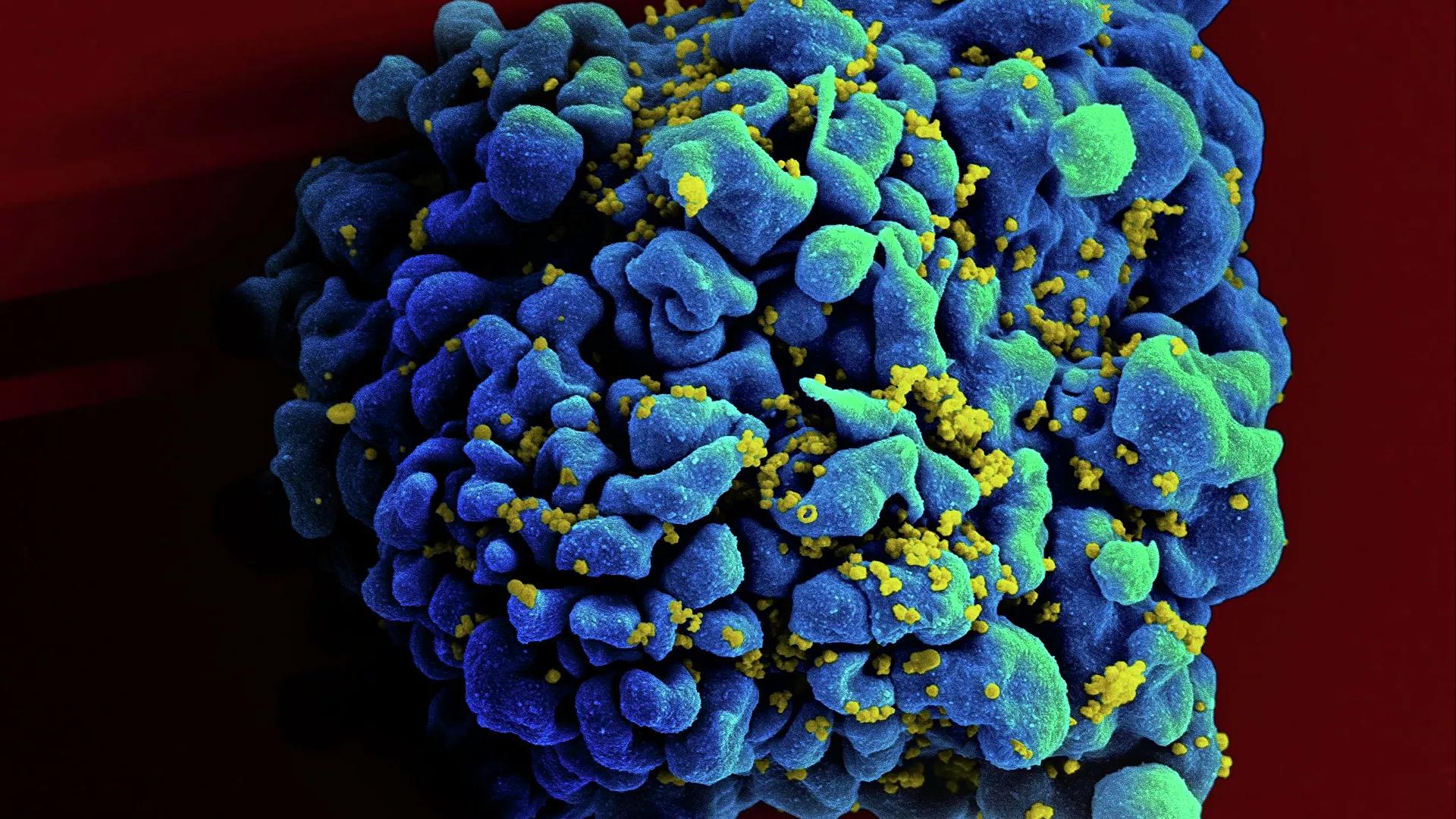 US Scientists Develop Method to 'Kick And Kill' Hidden HIV in Cells, Coming Closer to Curing Disease US Scientists Develop Method to 'Kick And Kill' Hidden HIV in Cells, Coming Closer to Curing Disease