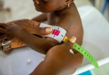 122 Children Under Five Diagnosed With Diabetes in Namibia 122 Children Under Five Diagnosed With Diabetes in Namibia