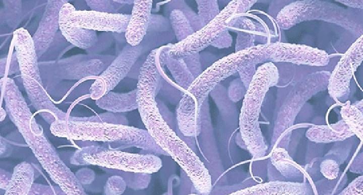 Situation de l’épidémie de choléra : 2.641 cas détectés, 88 décès à la date du 30 août 2021 Situation de l’épidémie de choléra : 2.641 cas détectés, 88 décès à la date du 30 août 2021