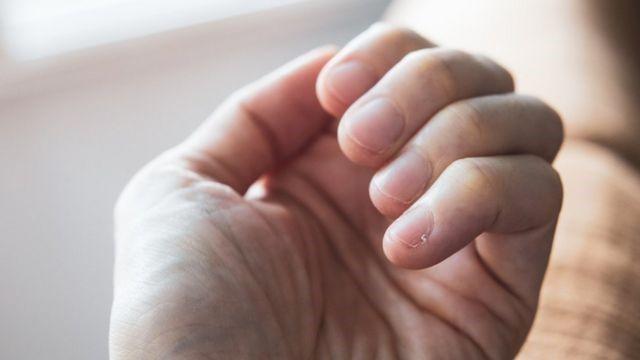 Comment les ongles avertissent de la santé et aident à détecter les maladies Comment les ongles avertissent de la santé et aident à détecter les maladies