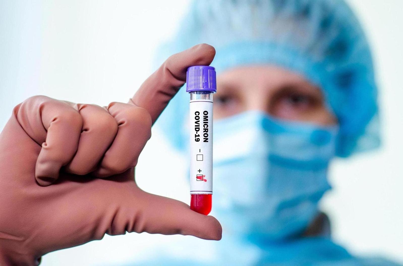 Covid long : l’infection, même légère, peut entrainer la production d’auto-anticorps Covid long : l’infection, même légère, peut entrainer la production d’auto-anticorps