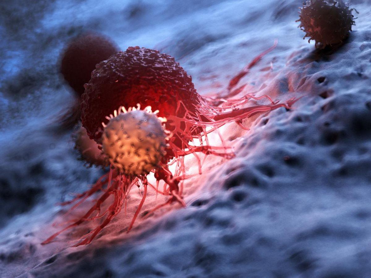 Cancer : l'environnement de la tumeur peut ralentir ou accélérer la maladie Cancer : l'environnement de la tumeur peut ralentir ou accélérer la maladie