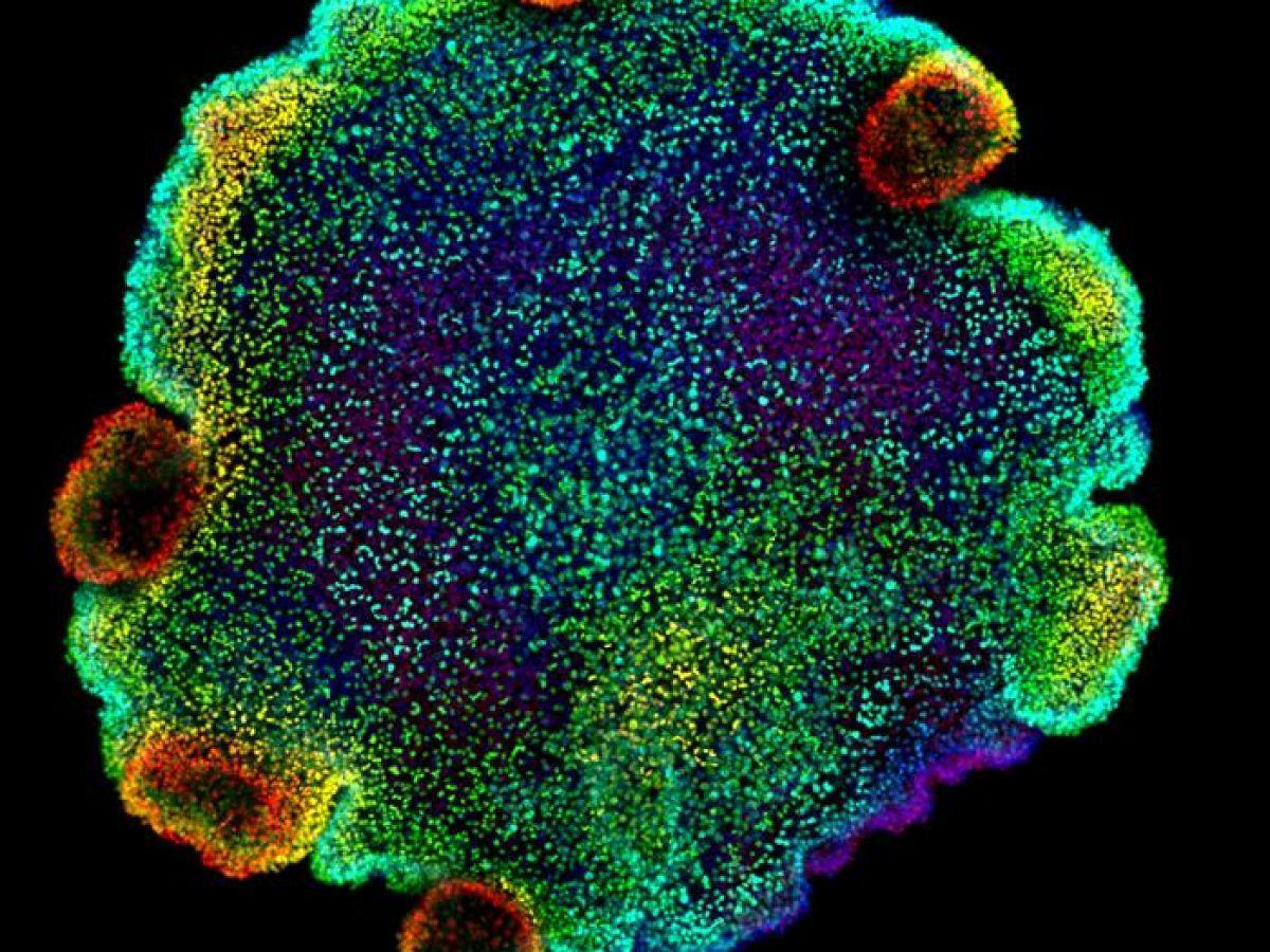 Un minuscule animal marin à l’origine de nos neurones ? Un minuscule animal marin à l’origine de nos neurones ?