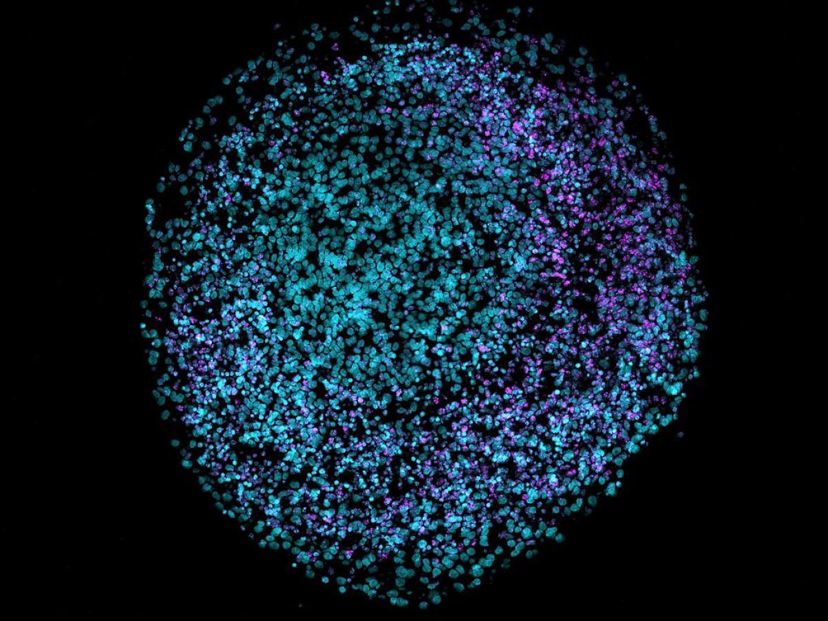 Des neurones sur des puces : une nouvelle forme d’intelligence artificielle Des neurones sur des puces : une nouvelle forme d’intelligence artificielle