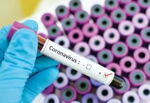 COVID-19 exposed inadequacies in our health system- Ishaku