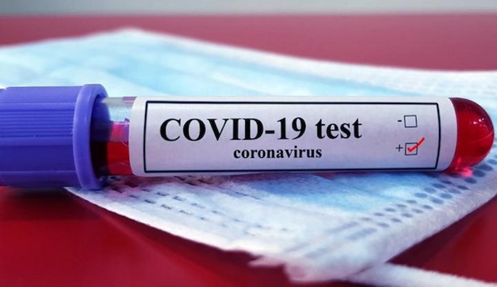 Again, Nigeria breaks highest single-day tally as 1,867 fresh COVID-19 infections take total caseload to 107, 345 Again, Nigeria breaks highest single-day tally as 1,867 fresh COVID-19 infections take total caseload to 107, 345