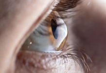 24 Million Nigerians Affected by Vision Loss 24 Million Nigerians Affected by Vision Loss