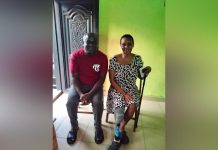 Cross River teacher loses leg to diabetes, begs for support Cross River teacher loses leg to diabetes, begs for support