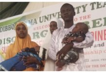 MAUTH Yola discharges successfully separated conjoined twins MAUTH Yola discharges successfully separated conjoined twins