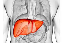 Preventing Fatty Liver and Liver Damage Steps Preventing Fatty Liver and Liver Damage Steps