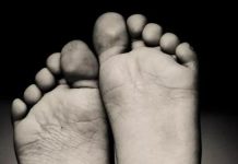 Cure for Chronic Diabetic Foot Ulcers Found Cure for Chronic Diabetic Foot Ulcers Found