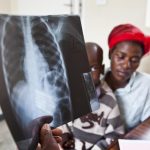 Tuberculosis Deaths Linked to Late Detection Tuberculosis Deaths Linked to Late Detection