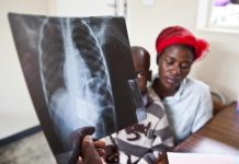 Tuberculosis Deaths Linked to Late Detection Tuberculosis Deaths Linked to Late Detection