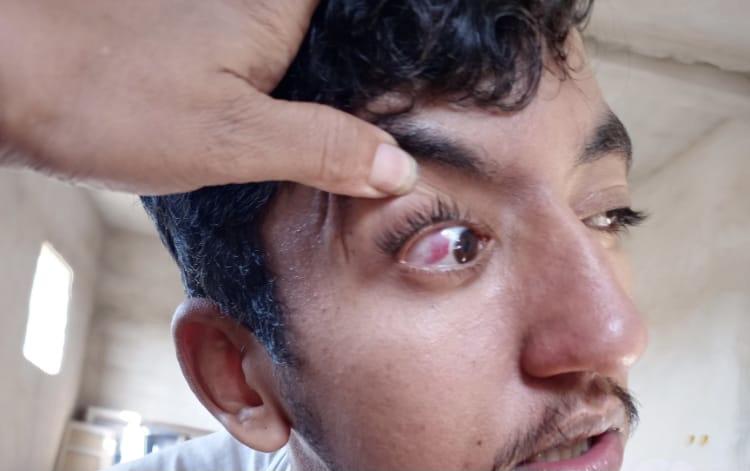 سلطات الاحتلال المغربي تداهم منزل عائلة أهل خيا وتخلف إصابات متفاوتة بمن في داخله وتعبث بمحتوياته (صور) سلطات الاحتلال المغربي تداهم منزل عائلة أهل خيا وتخلف إصابات متفاوتة بمن في داخله وتعبث بمحتوياته (صور)
