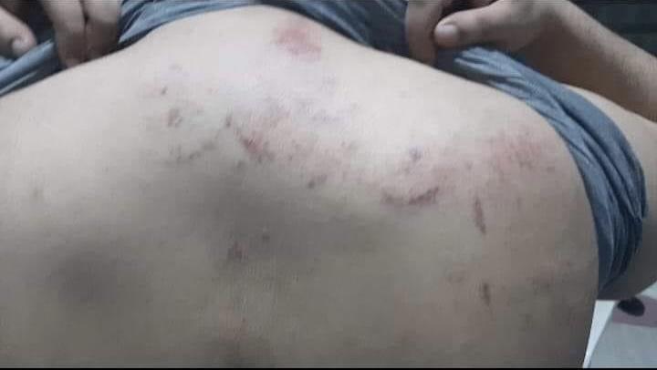 مؤسسة نشطاء تندد بما تعرض له رئيسها من اختطاف وتعذيب من طرف سلطات الاحتلال المغربي بمدينة العيون المحتلة مؤسسة نشطاء تندد بما تعرض له رئيسها من اختطاف وتعذيب من طرف سلطات الاحتلال المغربي بمدينة العيون المحتلة