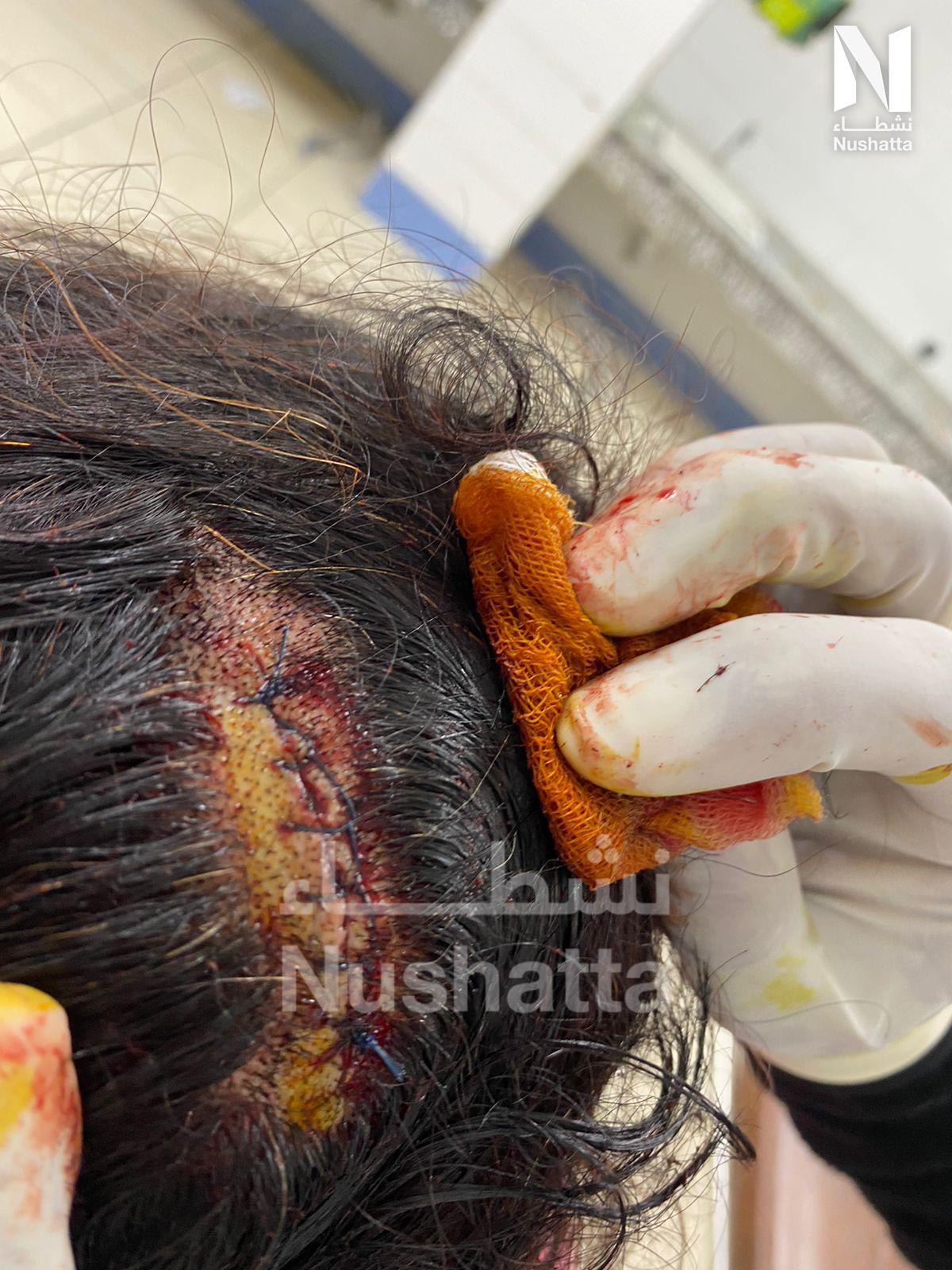 سلطات الاحتلال المغربي تقمع الصحراويين بالمدن المحتلة وتعرضهم للتعذيب والحصار بسبب تعبيرهم عن فرحتهم بفوز المنتخب الجزائري لكرة القدم سلطات الاحتلال المغربي تقمع الصحراويين بالمدن المحتلة وتعرضهم للتعذيب والحصار بسبب تعبيرهم عن فرحتهم بفوز المنتخب الجزائري لكرة القدم