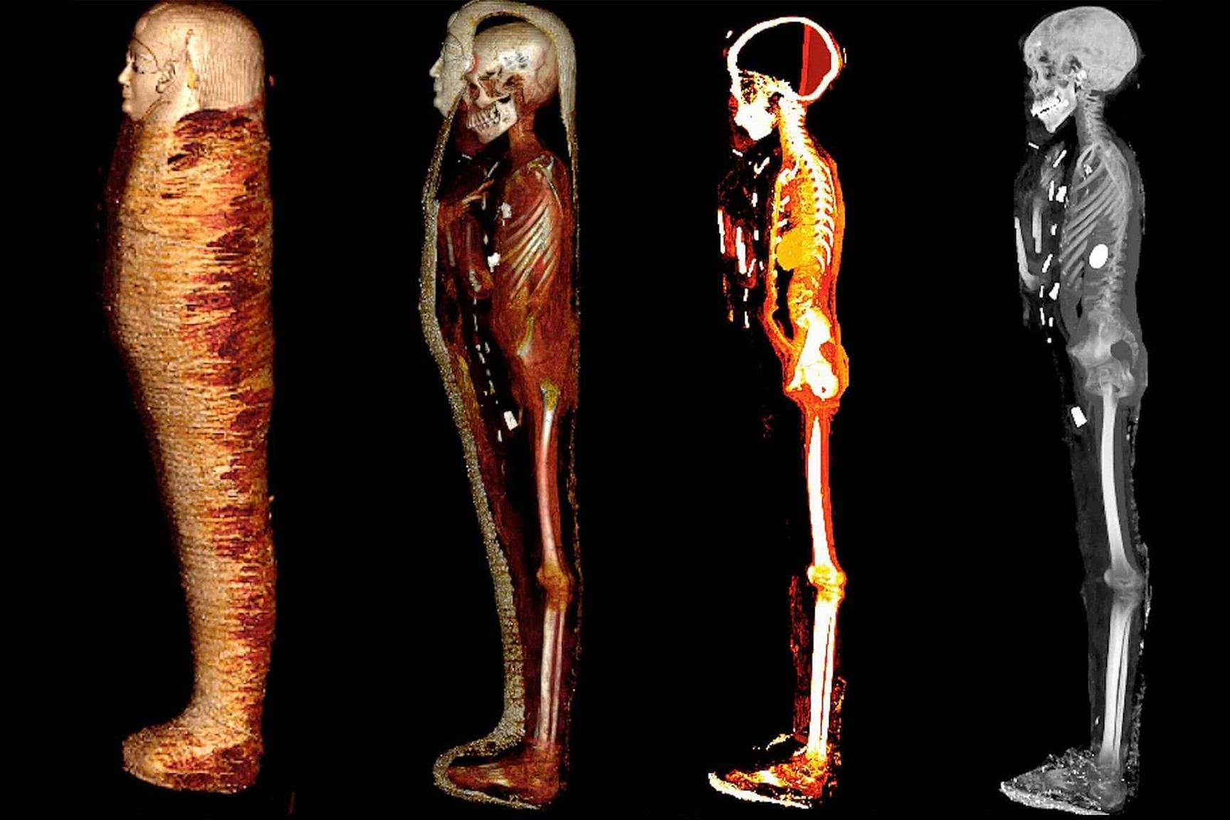 الأشعة المقطعية والطباعة ثلاثية الأبعاد تكشف أسرار مومياء “الصبي الذهبي” الأشعة المقطعية والطباعة ثلاثية الأبعاد تكشف أسرار مومياء “الصبي الذهبي”