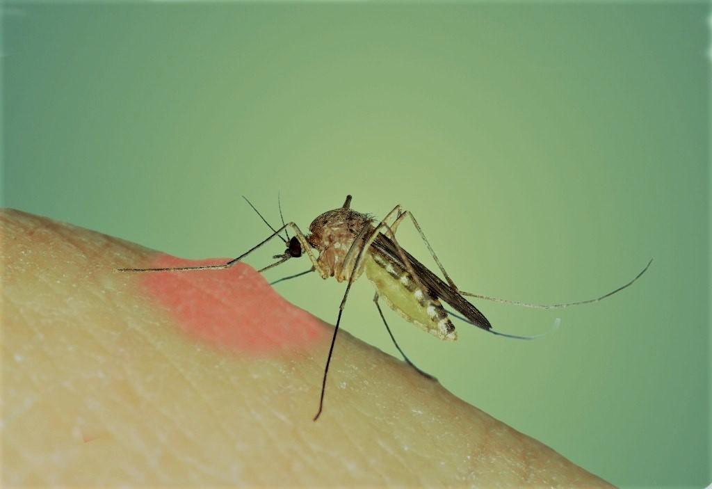 حل سحري لمنع الحكة المزعجة للدغات البعوض حل سحري لمنع الحكة المزعجة للدغات البعوض