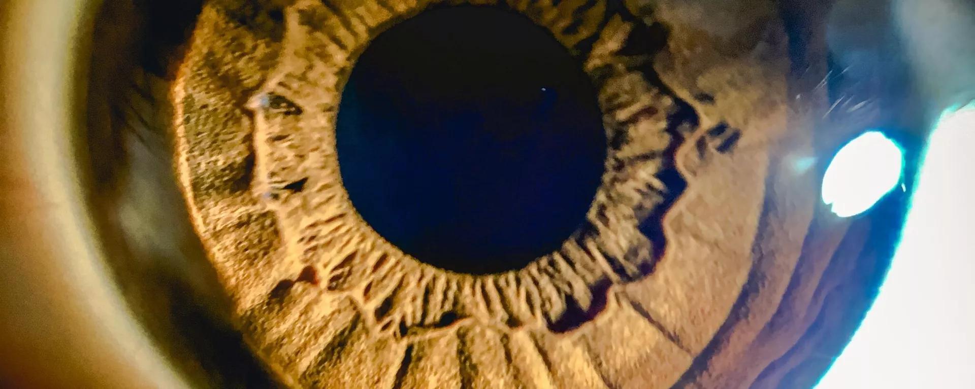 خبراء يحذرون من جراحات تغيير لون العيون خبراء يحذرون من جراحات تغيير لون العيون