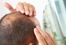 مشروب شائع يزيد من تساقط الشعر لدى الرجال مشروب شائع يزيد من تساقط الشعر لدى الرجال