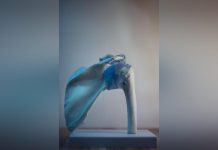 “ابتكار مسدس غراء ثوري لإصلاح العظام المكسورة” "ابتكار مسدس غراء ثوري لإصلاح العظام المكسورة"