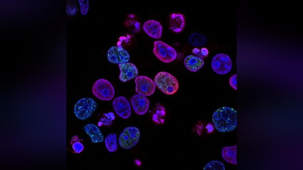 فطور صحي يقلل مخاطر سرطان القولون بحسب دراسة فطور صحي يقلل مخاطر سرطان القولون بحسب دراسة