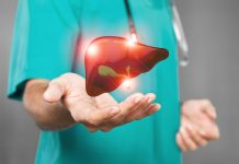 تغيرات البول تشير لبداية فشل الكبد تغيرات البول تشير لبداية فشل الكبد