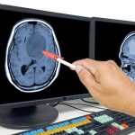 دواء شائع يحارب أخطر أنواع سرطان المخ دواء شائع يحارب أخطر أنواع سرطان المخ