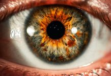 بكتيريا في العين قد تشير مبكرا لمرض ألزهايمر بكتيريا في العين قد تشير مبكرا لمرض ألزهايمر