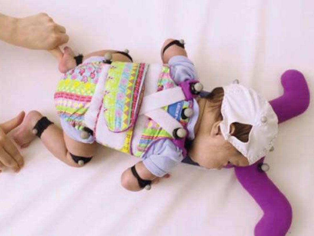 Un skateboard pour favoriser la marche des prématurés Un skateboard pour favoriser la marche des prématurés